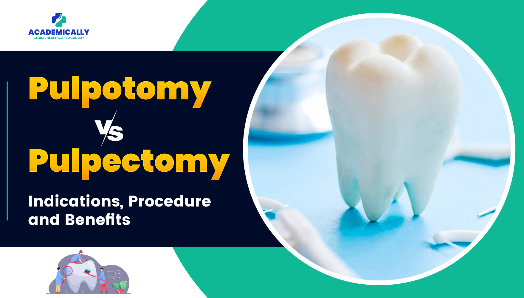 Pulpotomy vs Pulpectomy