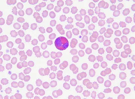 Eosinophil