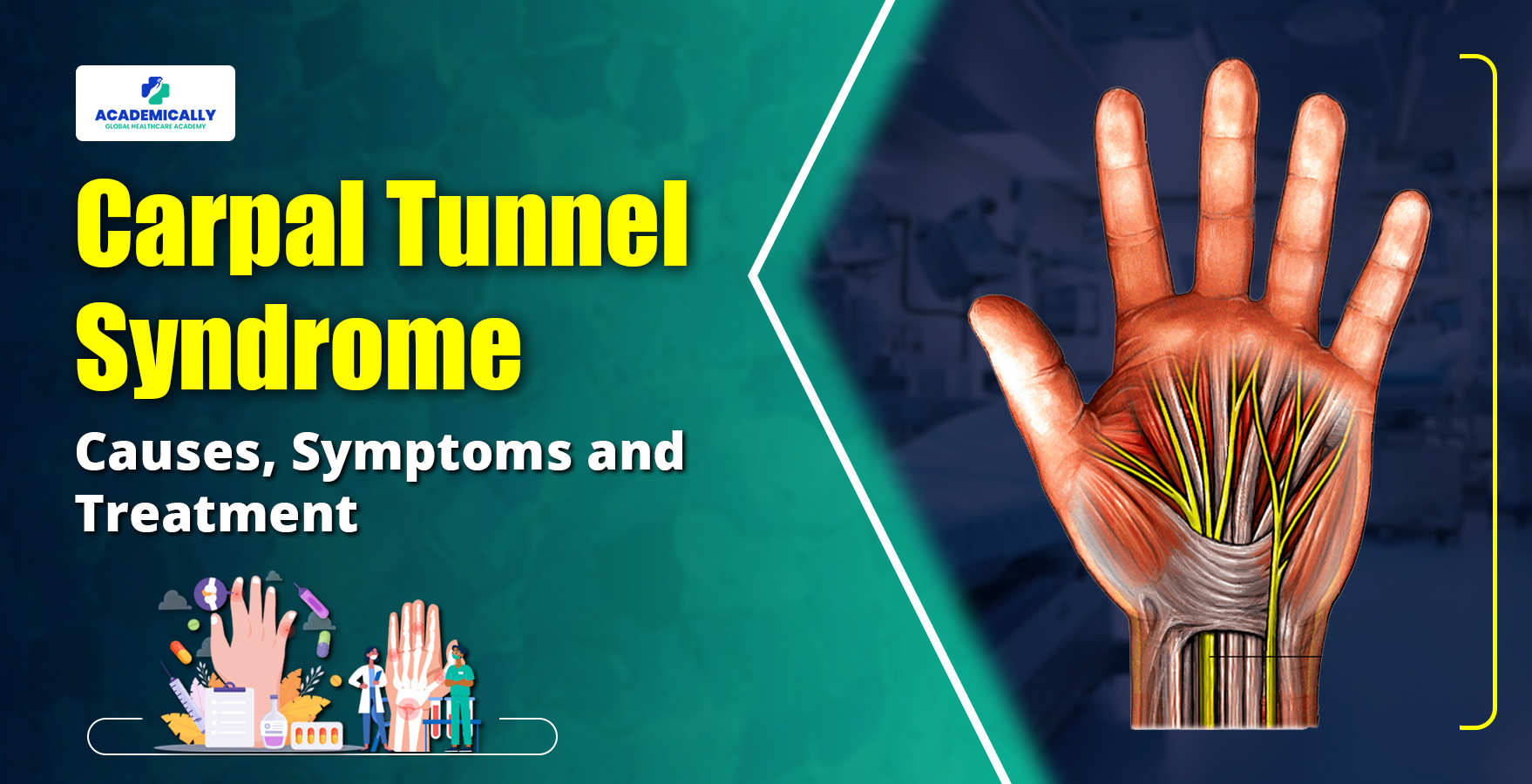 Carpal Tunnel Syndrome