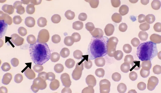 Mast cell