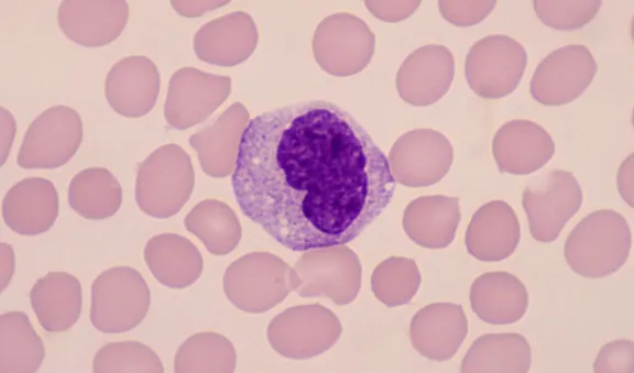 Monocyte