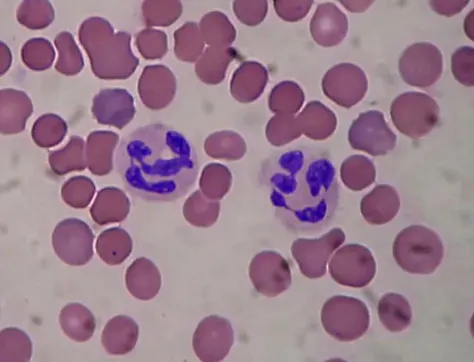 Neutrophil