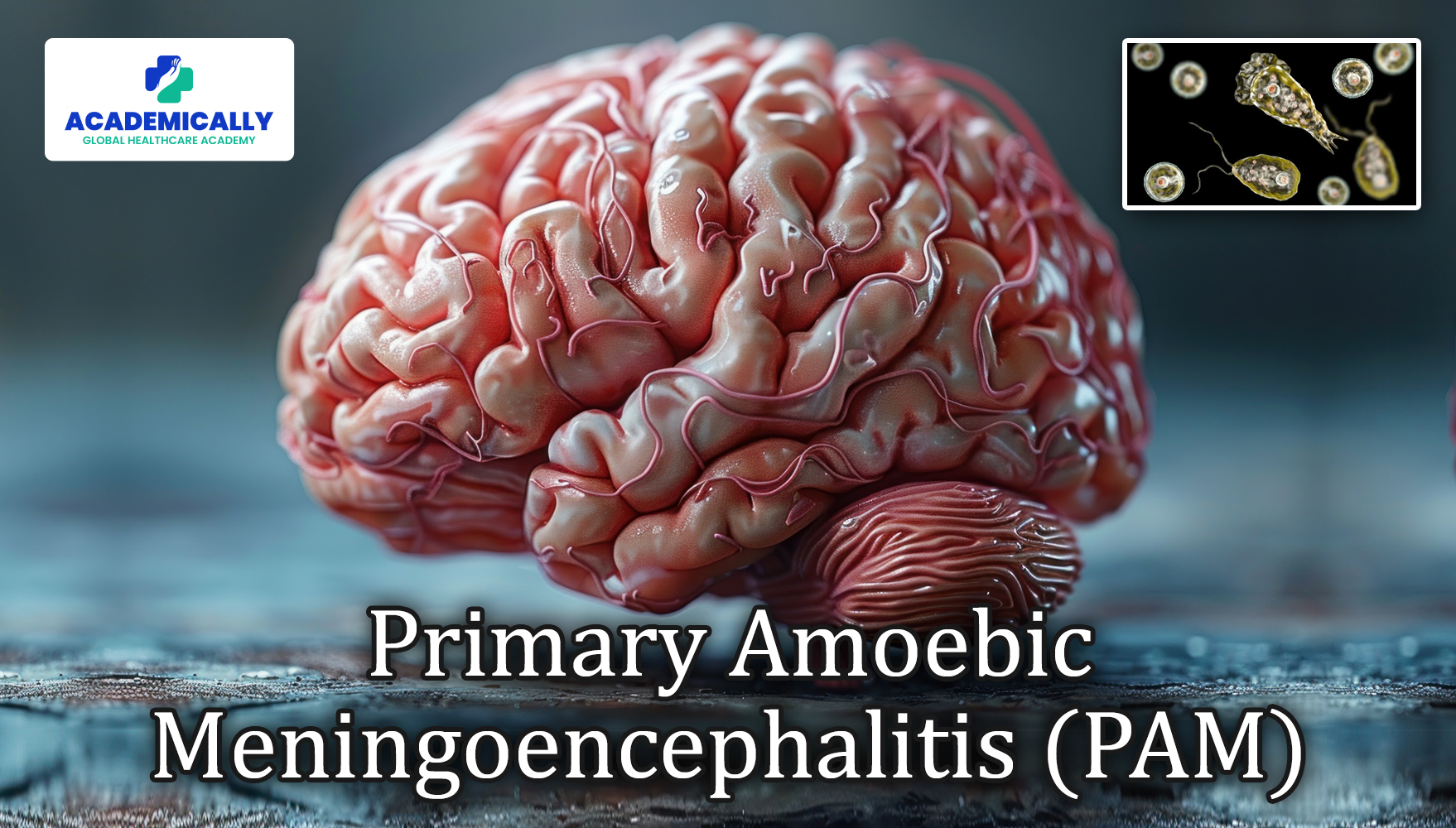 Primary Amoebic Meningoencephalitis (PAM)