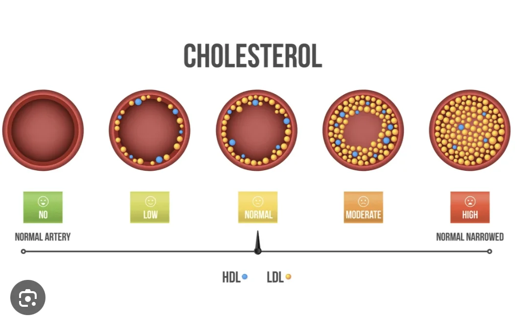 Solution to Lowering Cholesterol