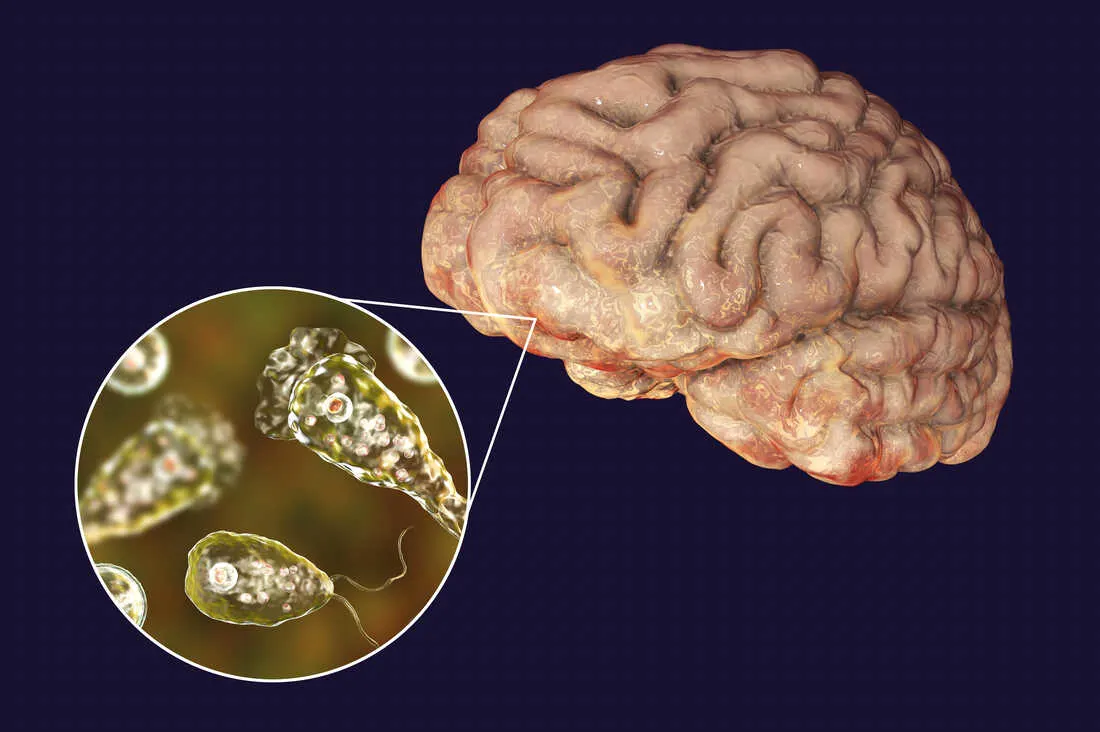 Symptoms of PAM