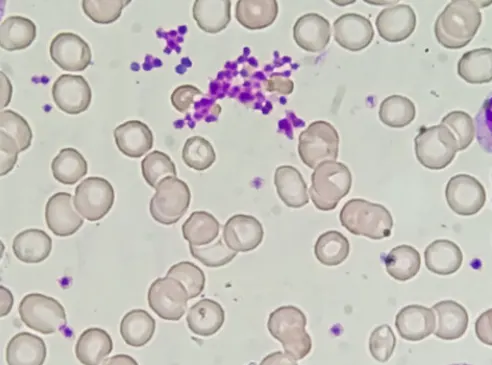 Thrombocyte